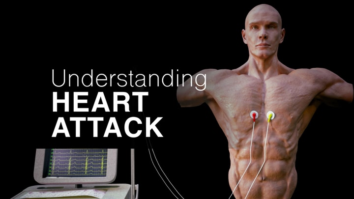 Understanding Heart Attack