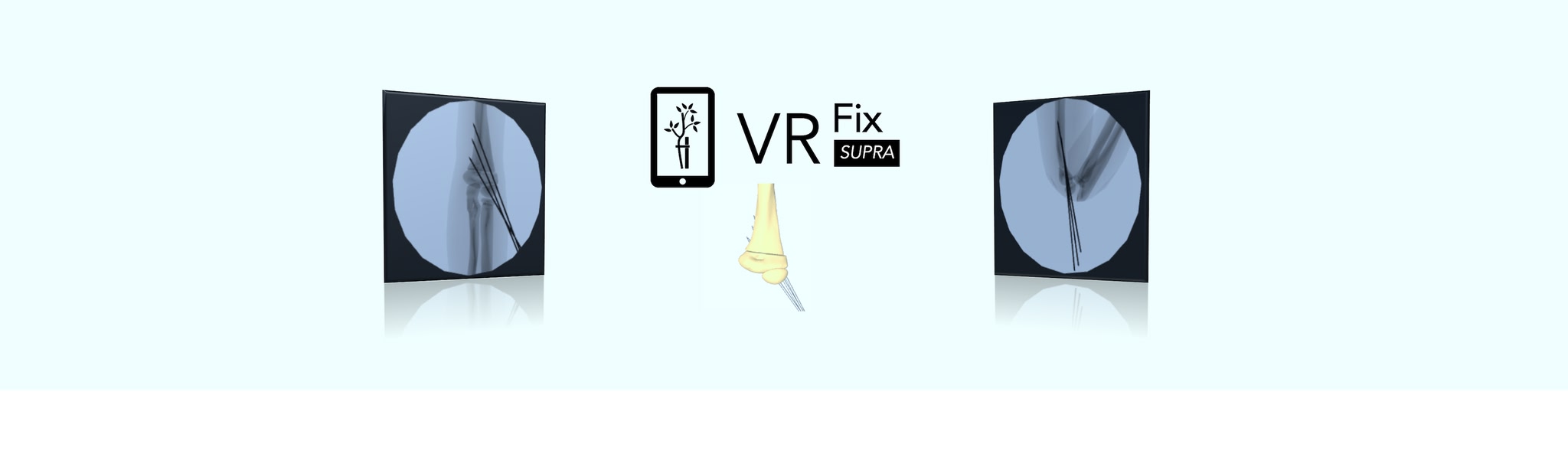 VR Fix Supra