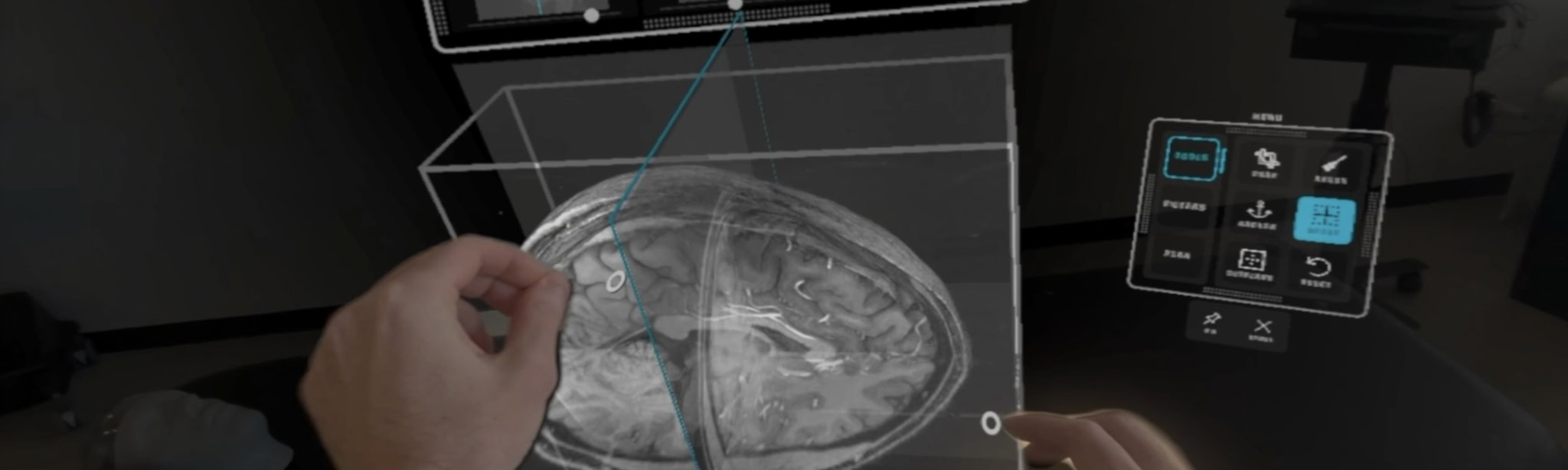 SurgicalAR Viewer