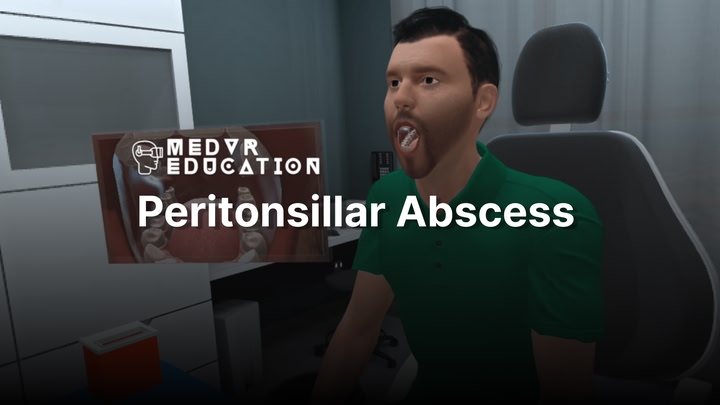 Peritonsillar Abscess Needle Aspiration
