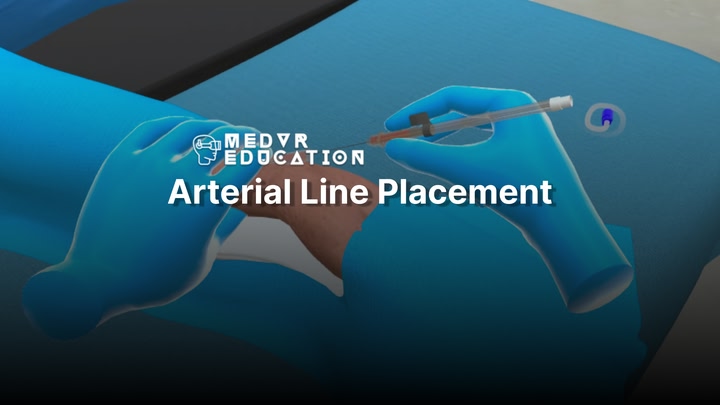 Arterial Line Placement