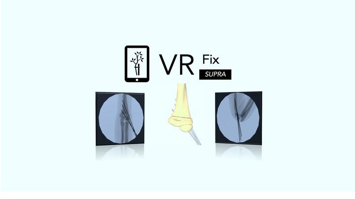 VR Fix Supra