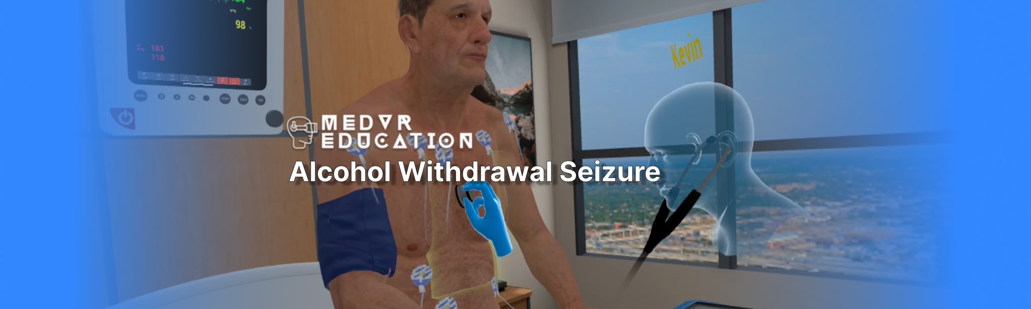 Alcohol Withdrawal Seizure