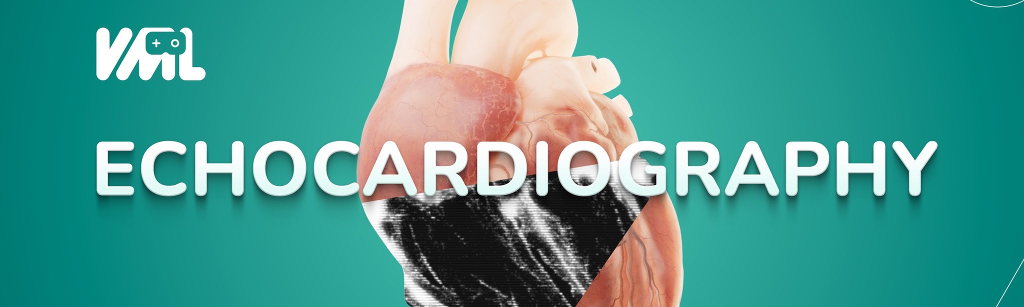Echocardiography VR - VML