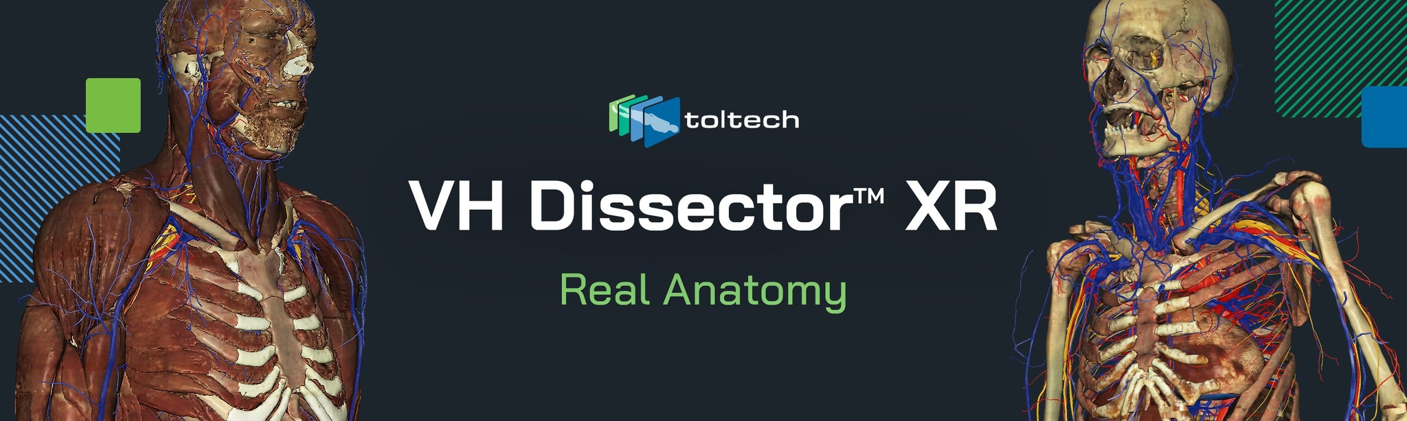 VH Dissector XR